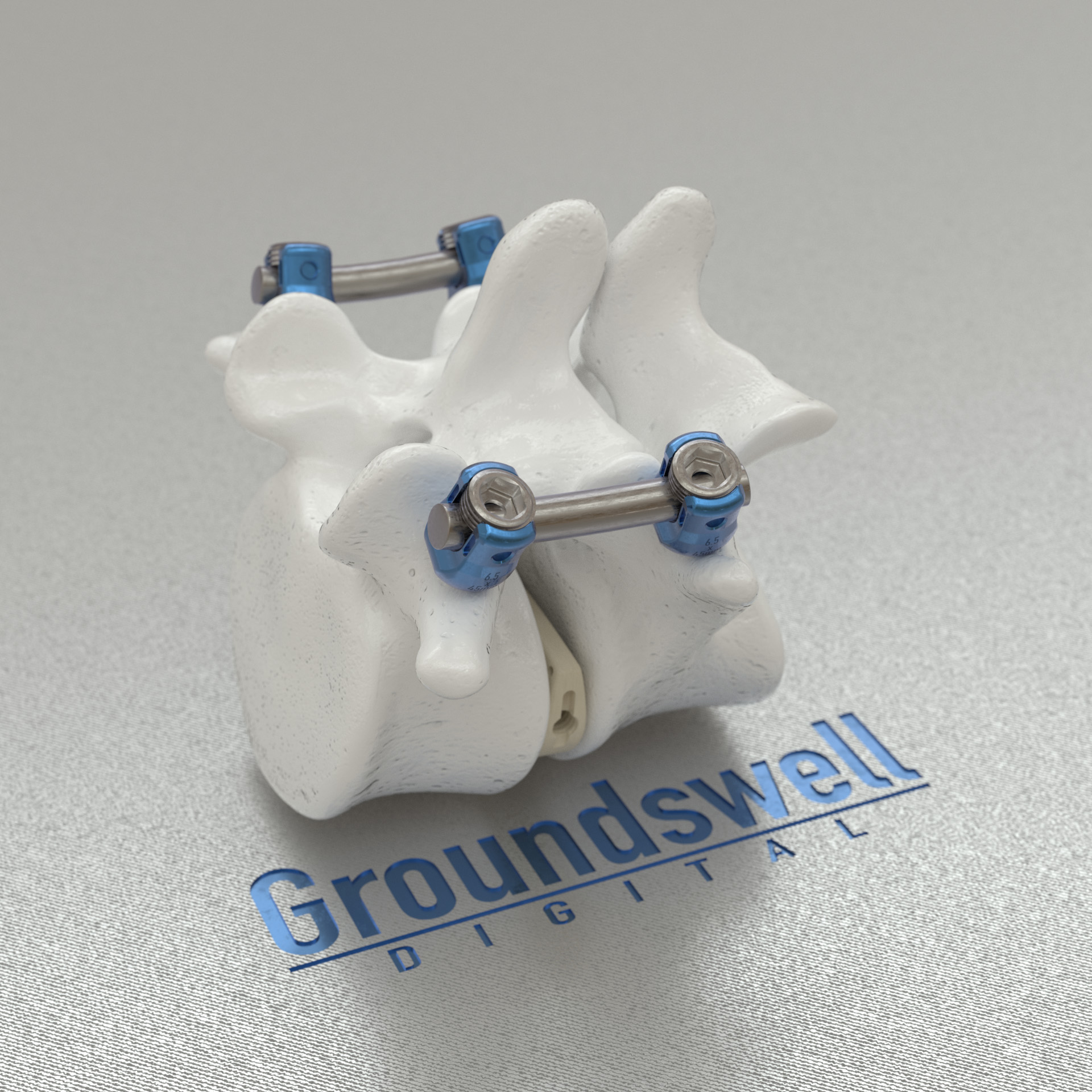 Spinal Fixation System